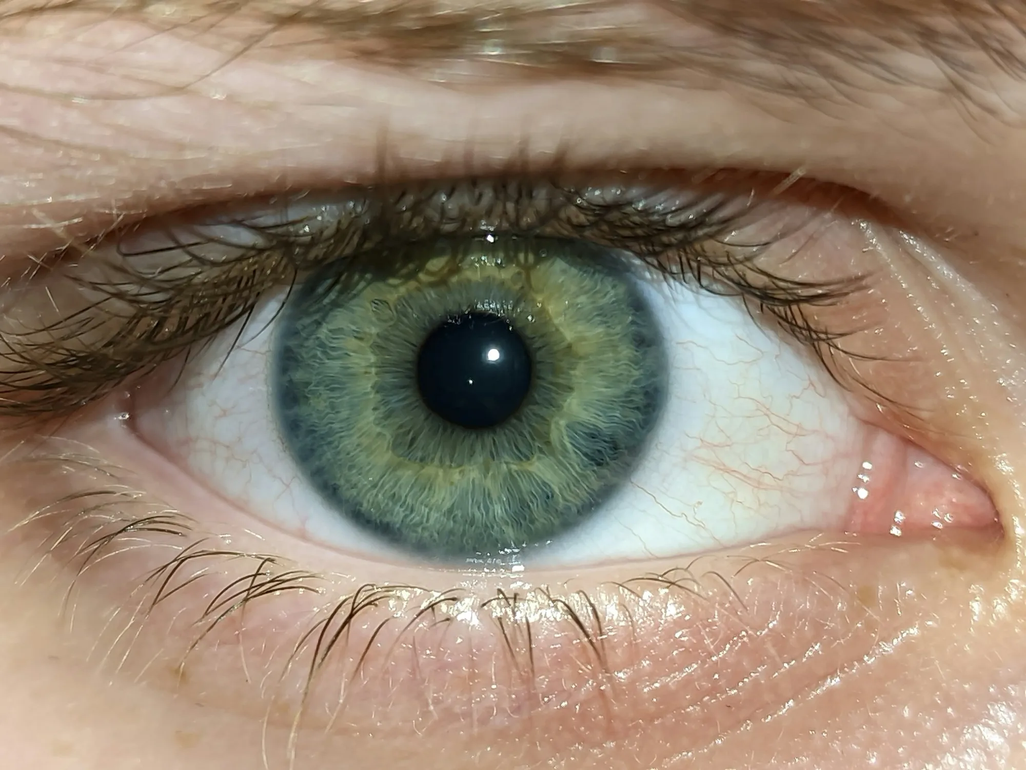 Eye