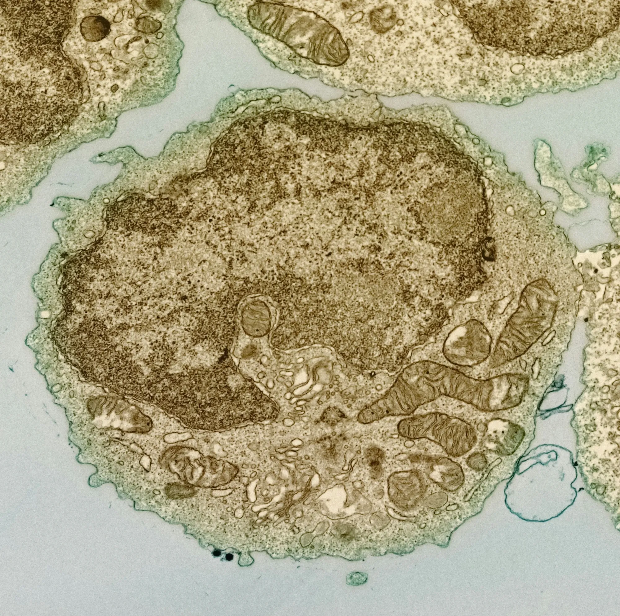Human B Lymphocyte Transmission electron micrograph of a B cell from a human donor.