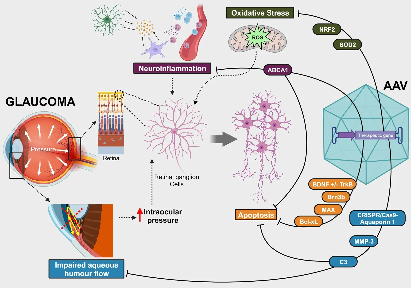AAV-mediated gene therapies for glaucoma and uveitis