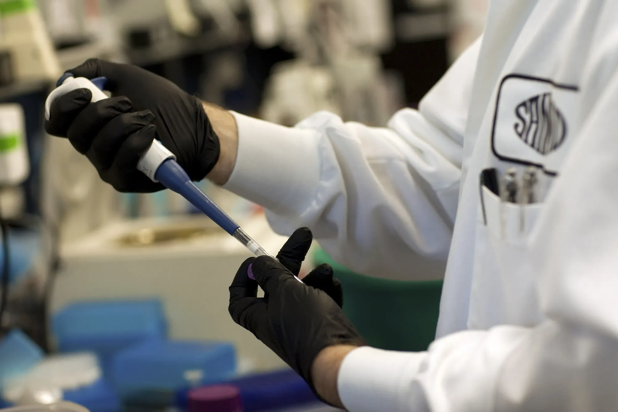 Sangamo Moves Forward with Gene Therapy for Fabry Disease