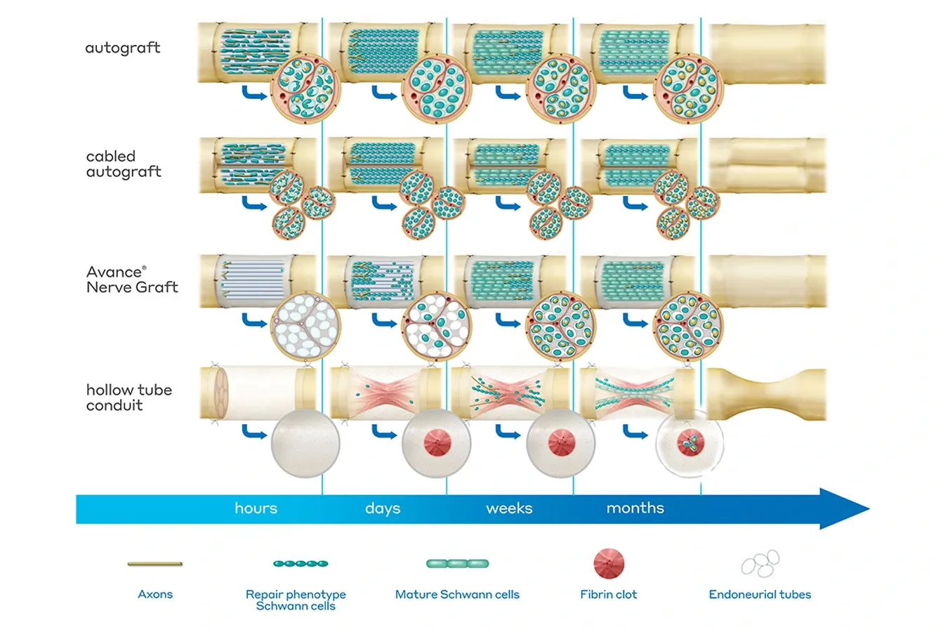 Axogen Stock Soars on FDA Approval for Nerve Repair Treatment