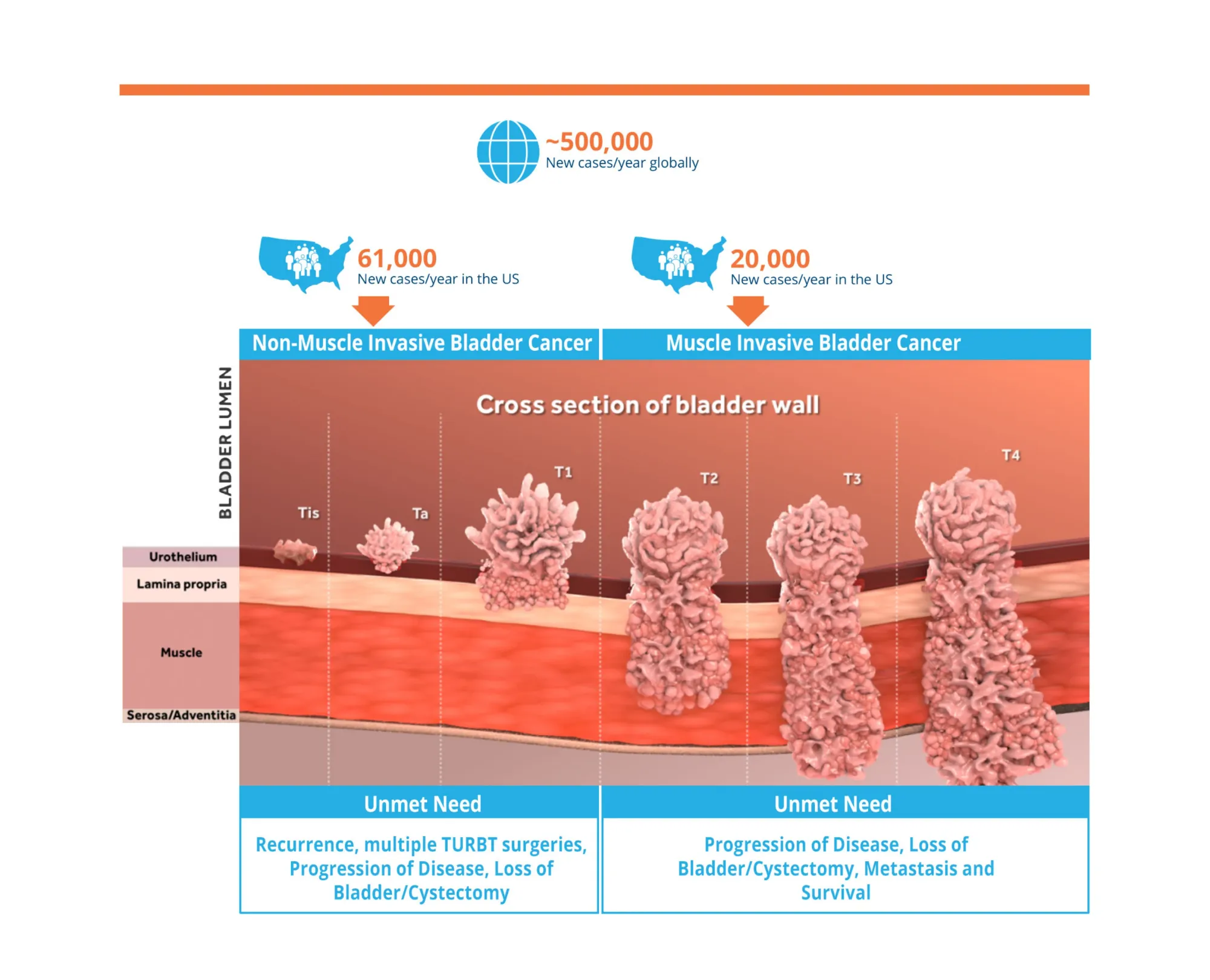 Leerink Upgrades Relmada Therapeutics With $8 Price Target