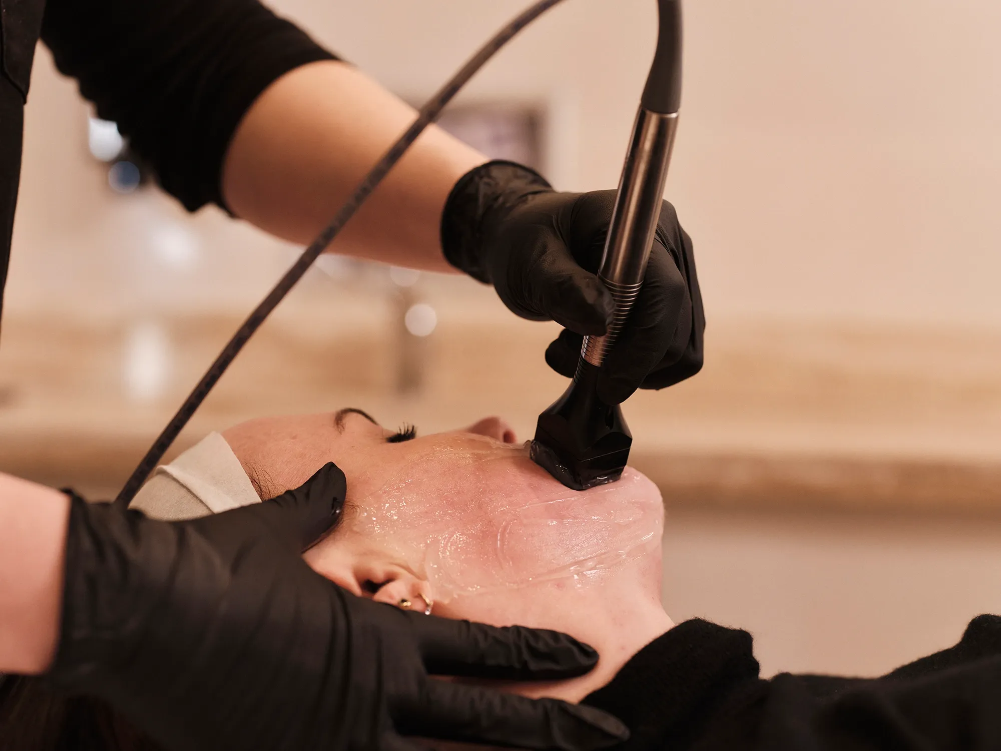 InMode Ends Sale Talks: No Good Offers Found