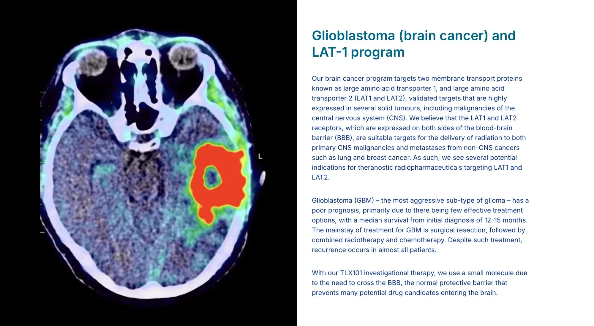 FDA Accepts Telix Pixclara NDA: Brain Cancer Imaging Tool on Track for September 2026 Decision