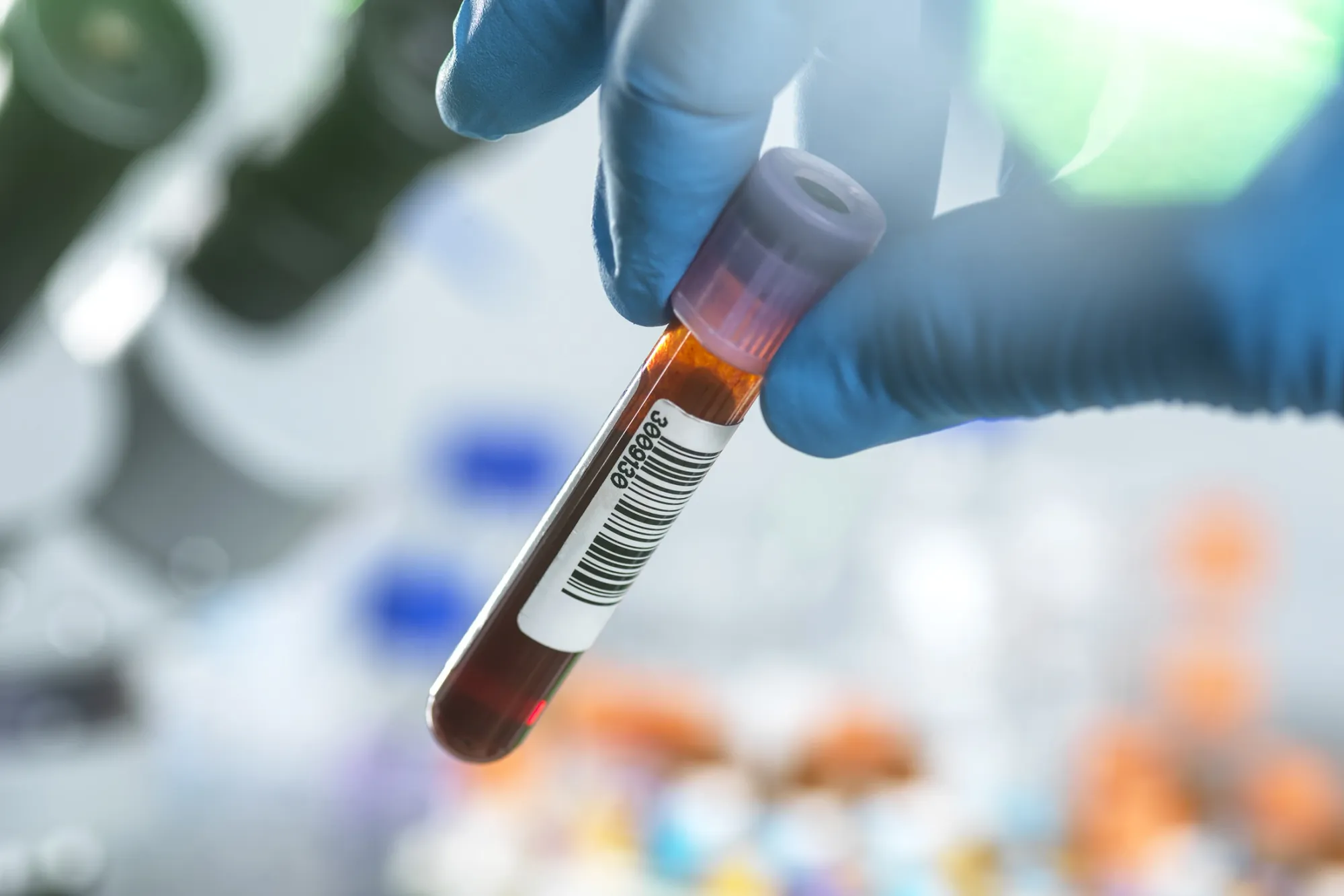 QuidelOrtho Eyes $1.5B Sale of COVID-Era Rapid Testing Business