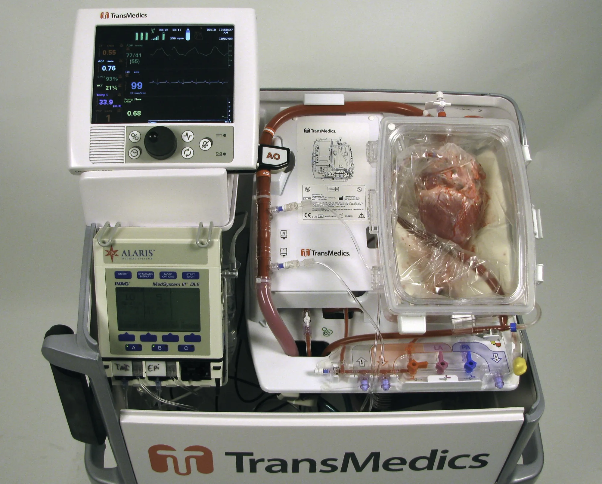 TD Cowen Boosts TransMedics Price Target to $120 on Strong Transplant Growth