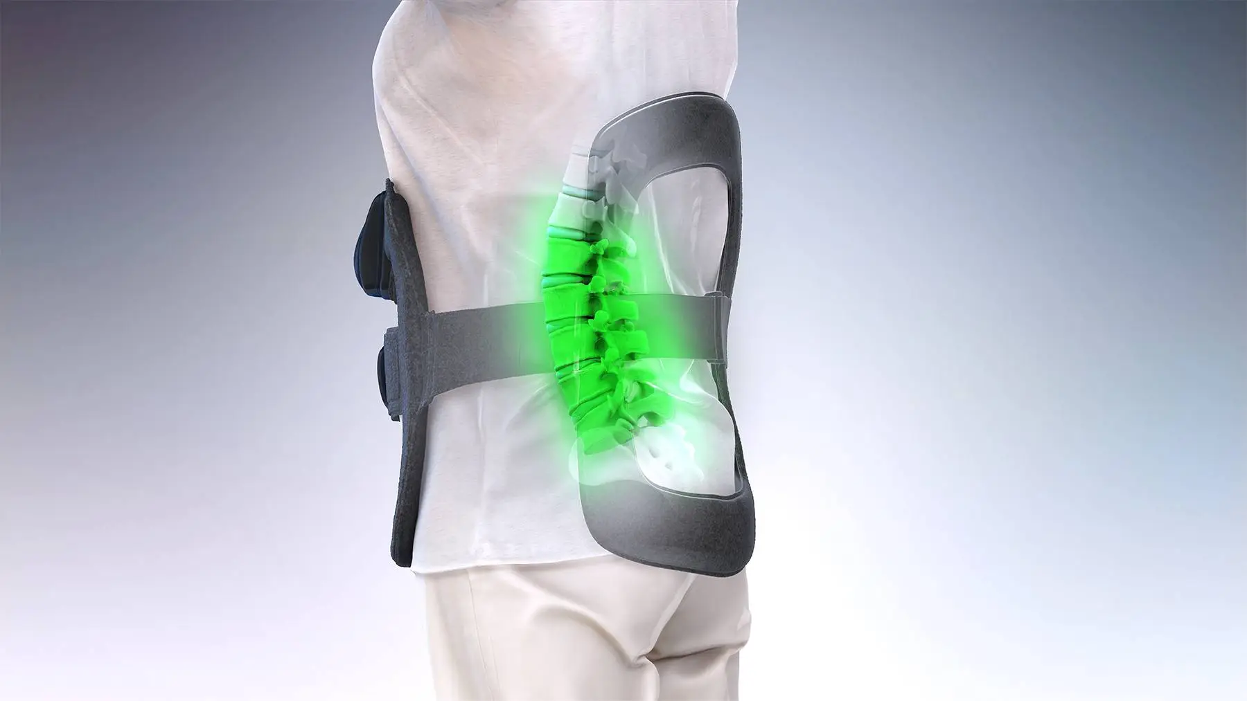 CMS Reverses Course on Medicare Reimbursement for Orthofix Bone Growth Stimulators