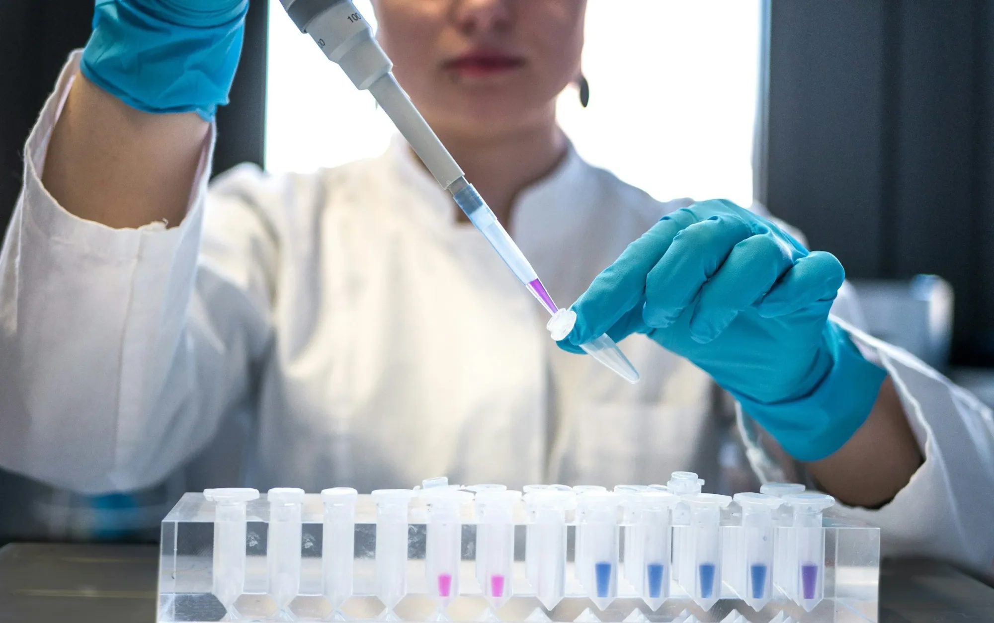 CareDx Shares Surge After Medicare Finalizes Transplant Testing Coverage