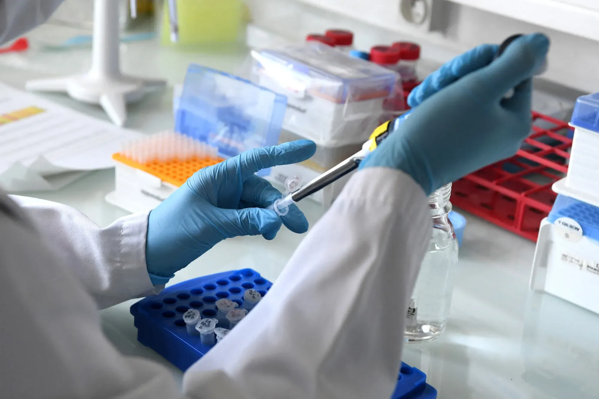 Wall Street Turns Bullish on Capricor as FDA Extends Review for Deramiocel to November