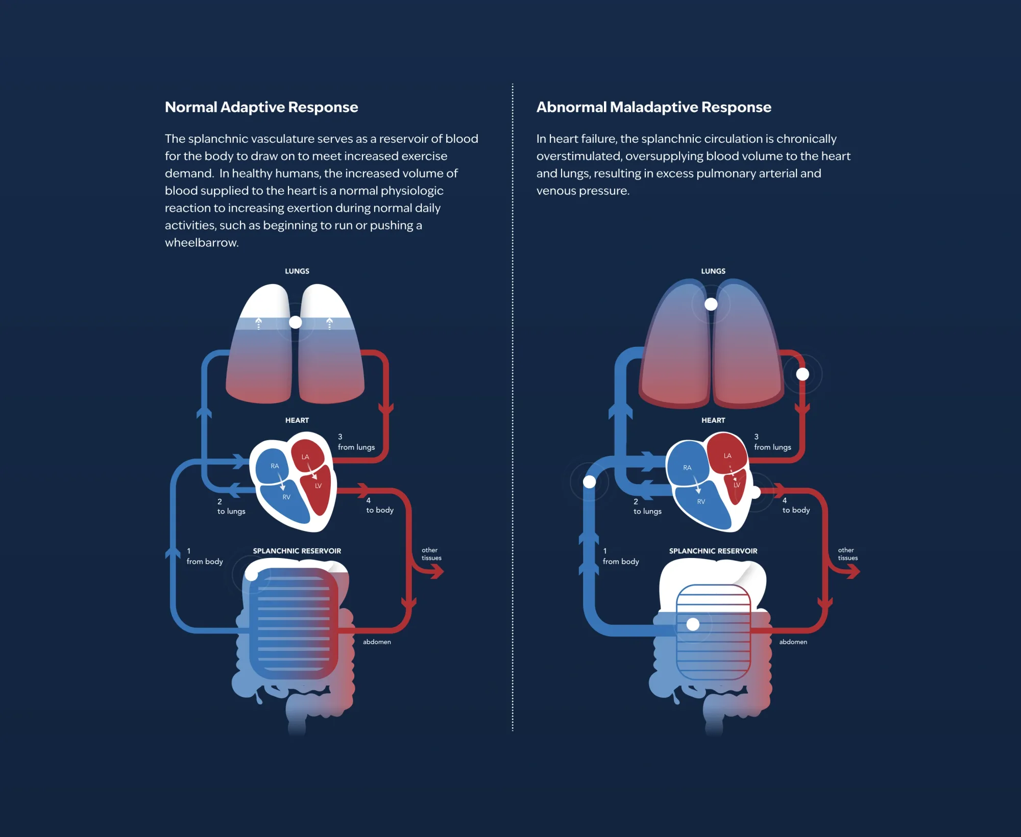 Tenax’s TNX-103 Misses Primary Endpoint in Late-Stage Heart Failure Trial