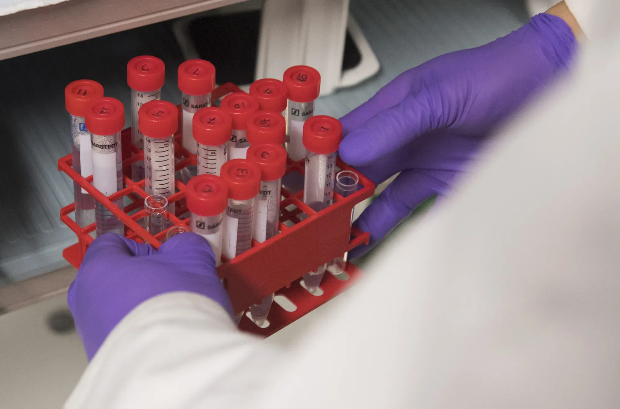 Grail Stock Jumps as FDA Papers Signal Galleri Panel Path