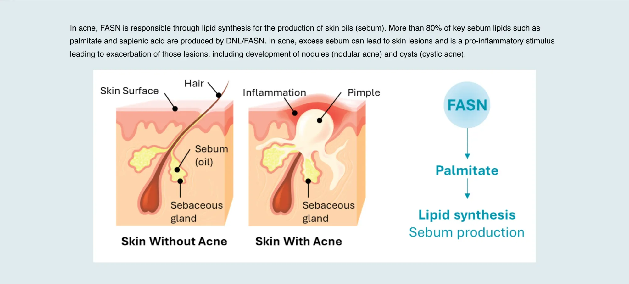 Goldman Sachs Starts Sagimet at Sell, Sees 35% Downside Into AURORA