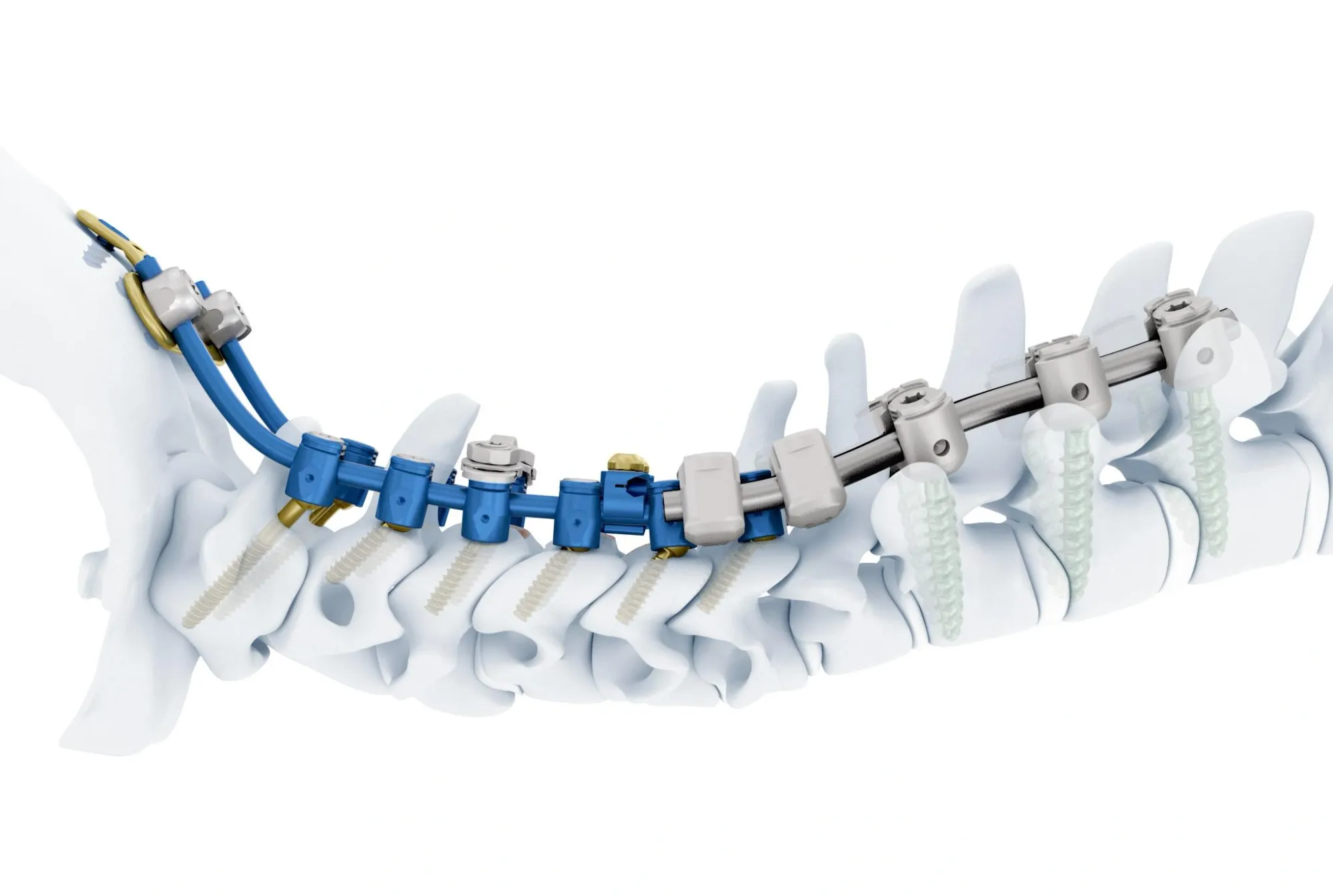 J&J in Talks to Sell DePuy Synthes to Apollo for About $20 Billion