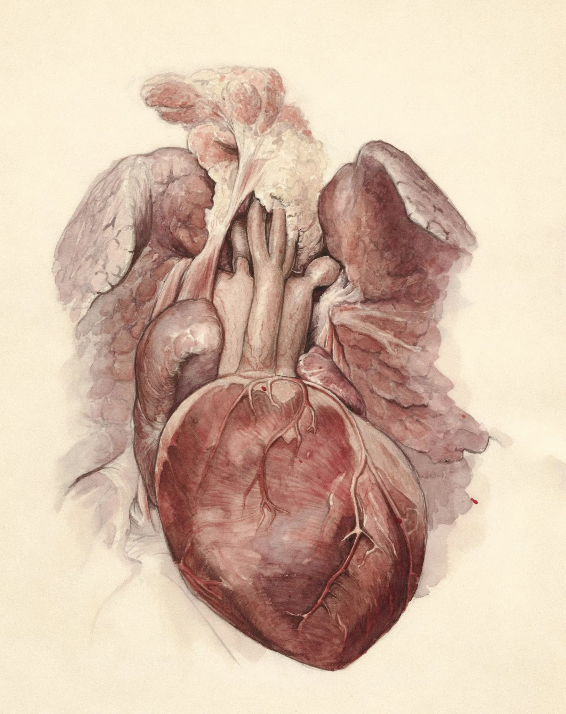 Another Setback for Novo: Two More Ziltivekimab Cardiovascular Trials Ended