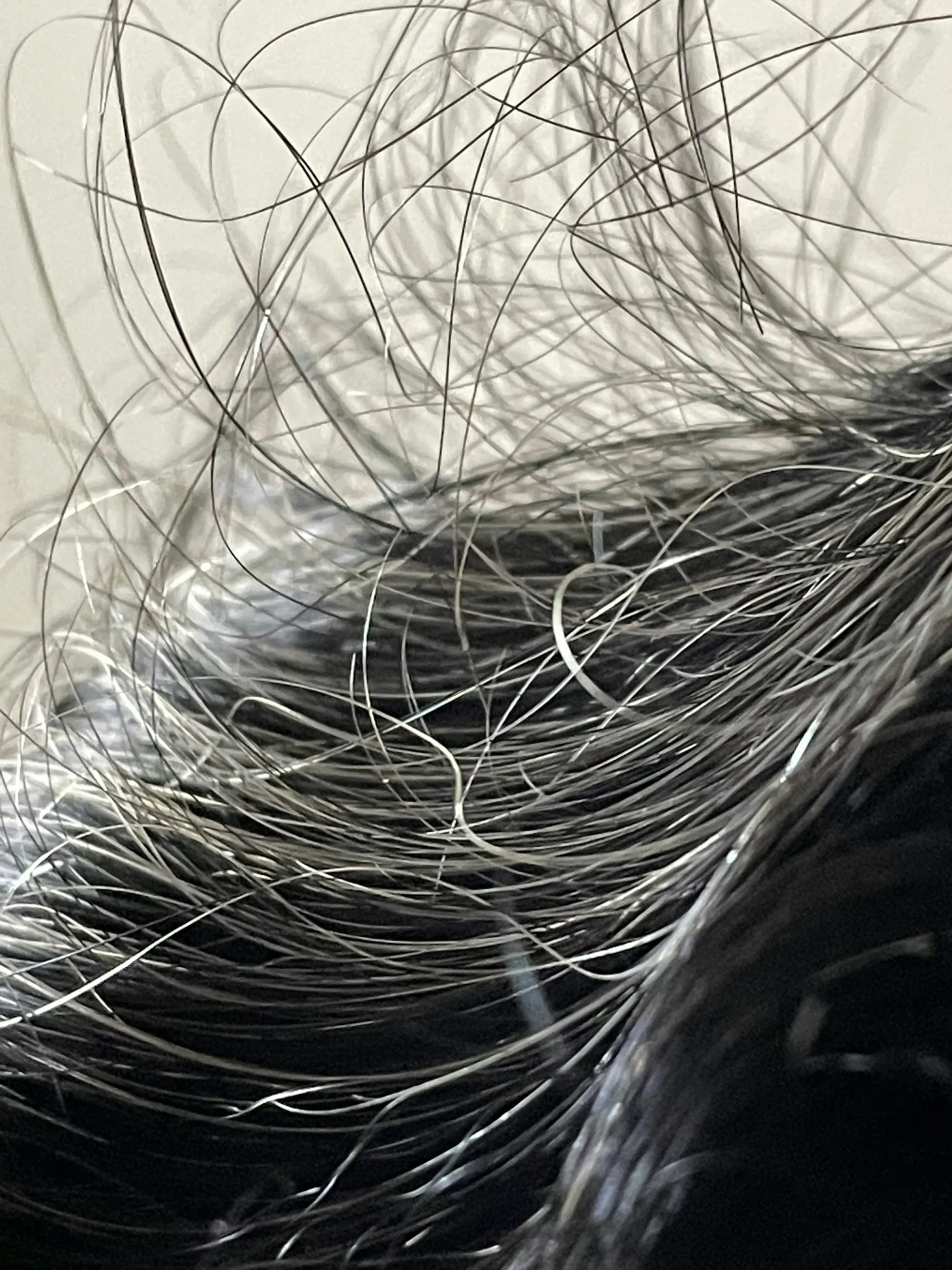 Jefferies Initiates Q32 Bio at Buy With $29 Target on Alopecia Potential