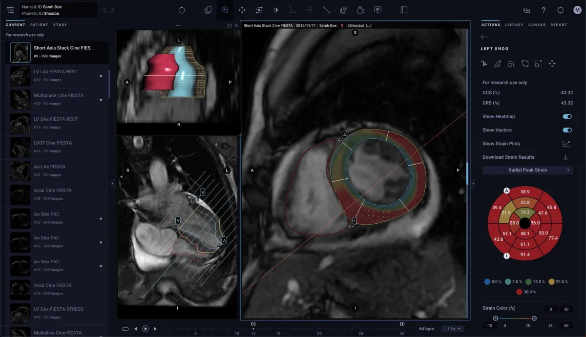 Tempus AI's Heart Scan Update Gets FDA Green Light!