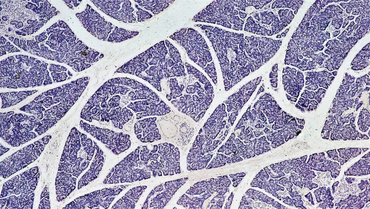 Arcturus Shares Plunge After Mixed Results in Cystic Fibrosis Spray Trial