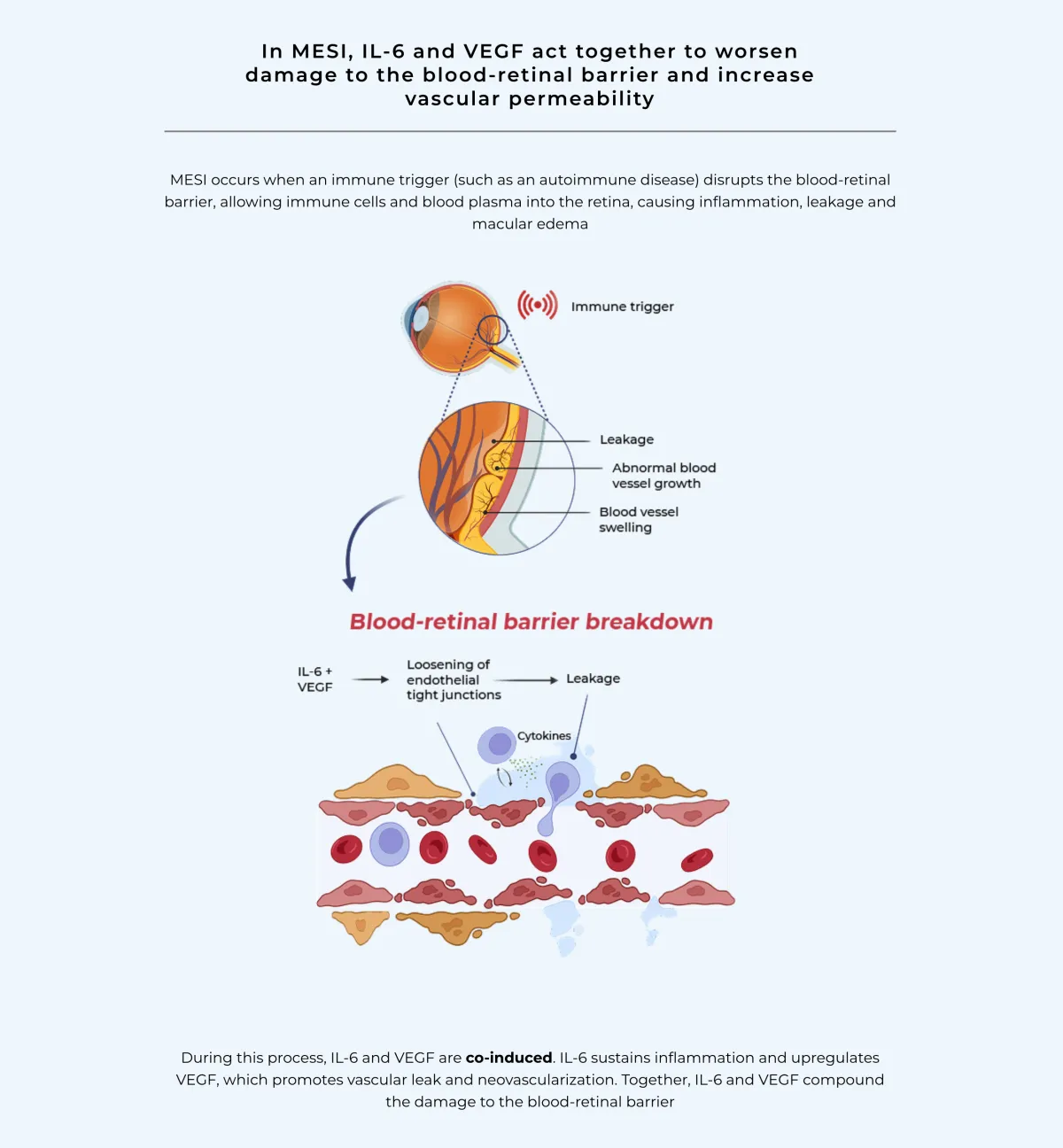 JPMorgan Upgrades Kodiak Sciences on KSI-101 Potential