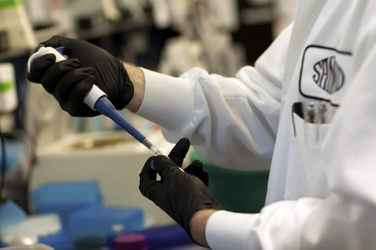 Sangamo Moves Forward with Gene Therapy for Fabry Disease