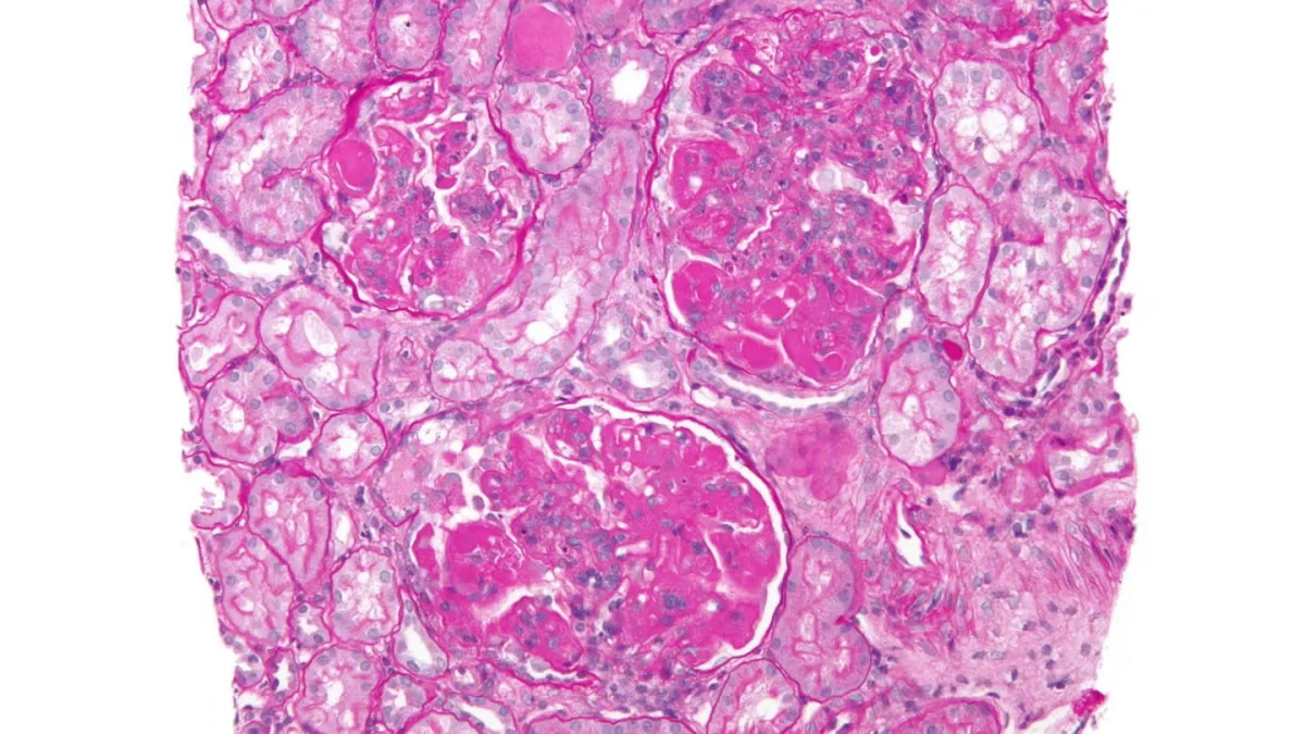 Jefferies Upgrades Aurinia Pharmaceuticals to Buy, Raises Target to $21