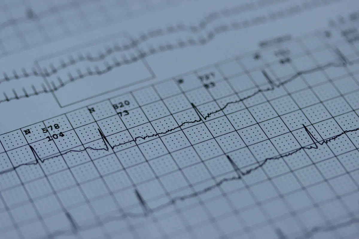 HeartBeam Receives FDA Setback on ECG Software Application