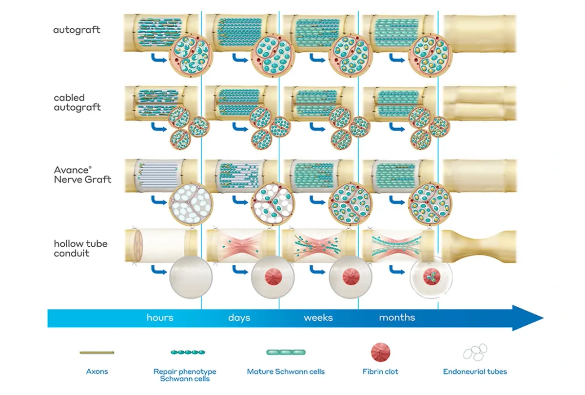 Axogen Stock Soars on FDA Approval for Nerve Repair Treatment