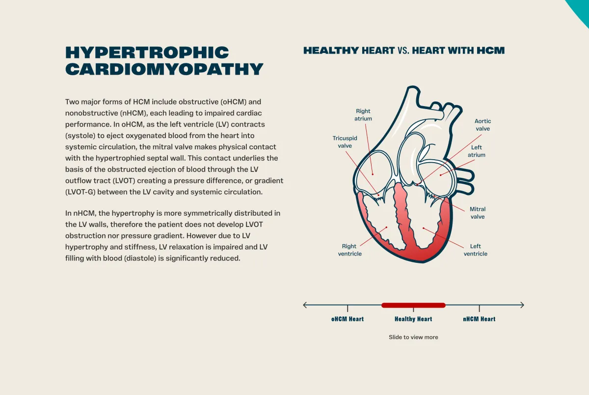 JPMorgan Boosts Edgewise Therapeutics Target to $45: Bullish on 2026 Catalysts and EDG-7500 Momentum