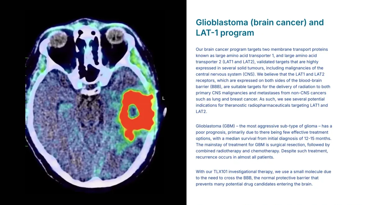 FDA Accepts Telix Pixclara NDA: Brain Cancer Imaging Tool on Track for September 2026 Decision