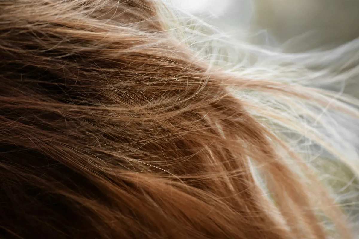 Veradermics Surges on Analyst Backing and Promising Oral Hair Loss Data in Women