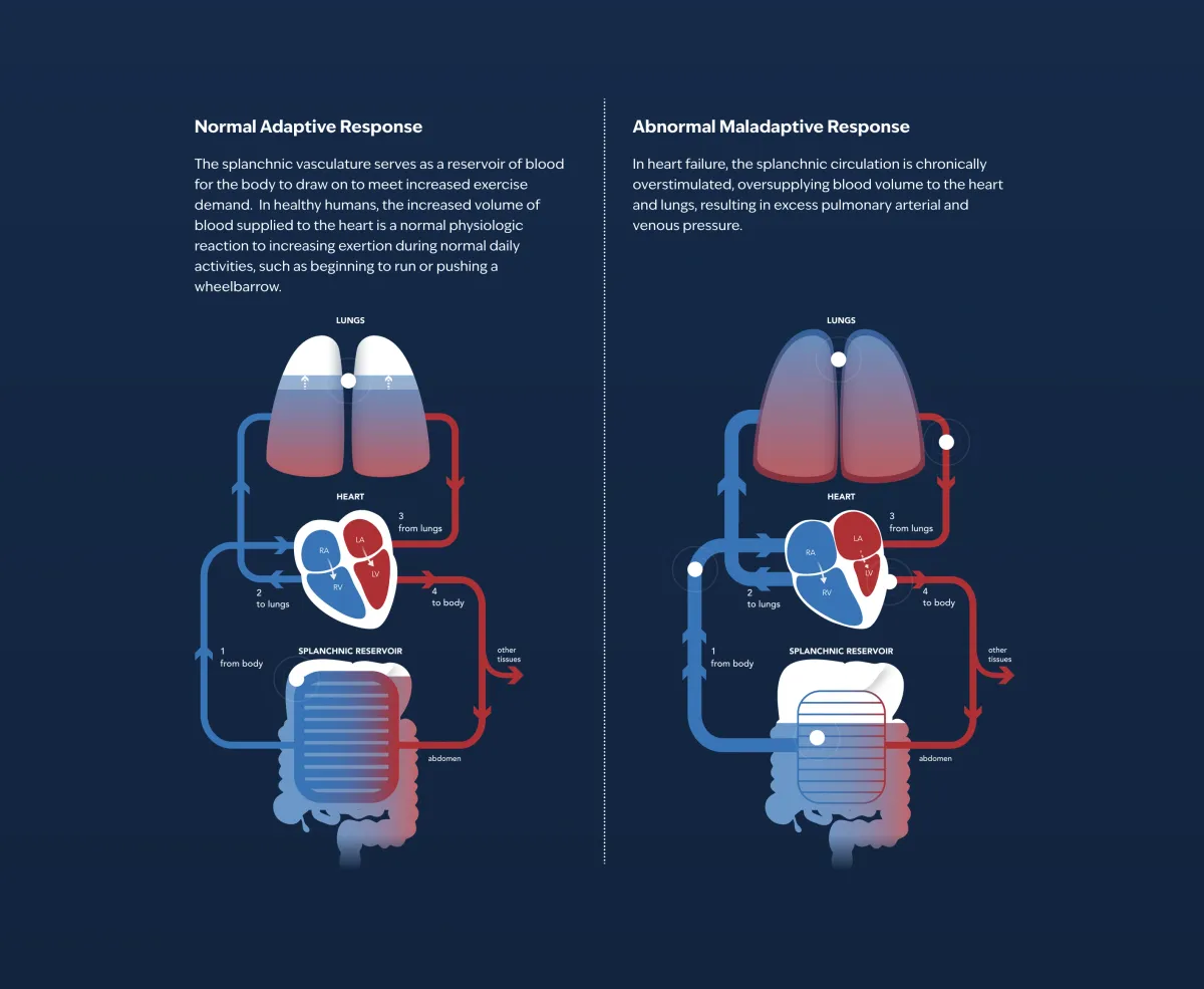 Tenax’s TNX-103 Misses Primary Endpoint in Late-Stage Heart Failure Trial