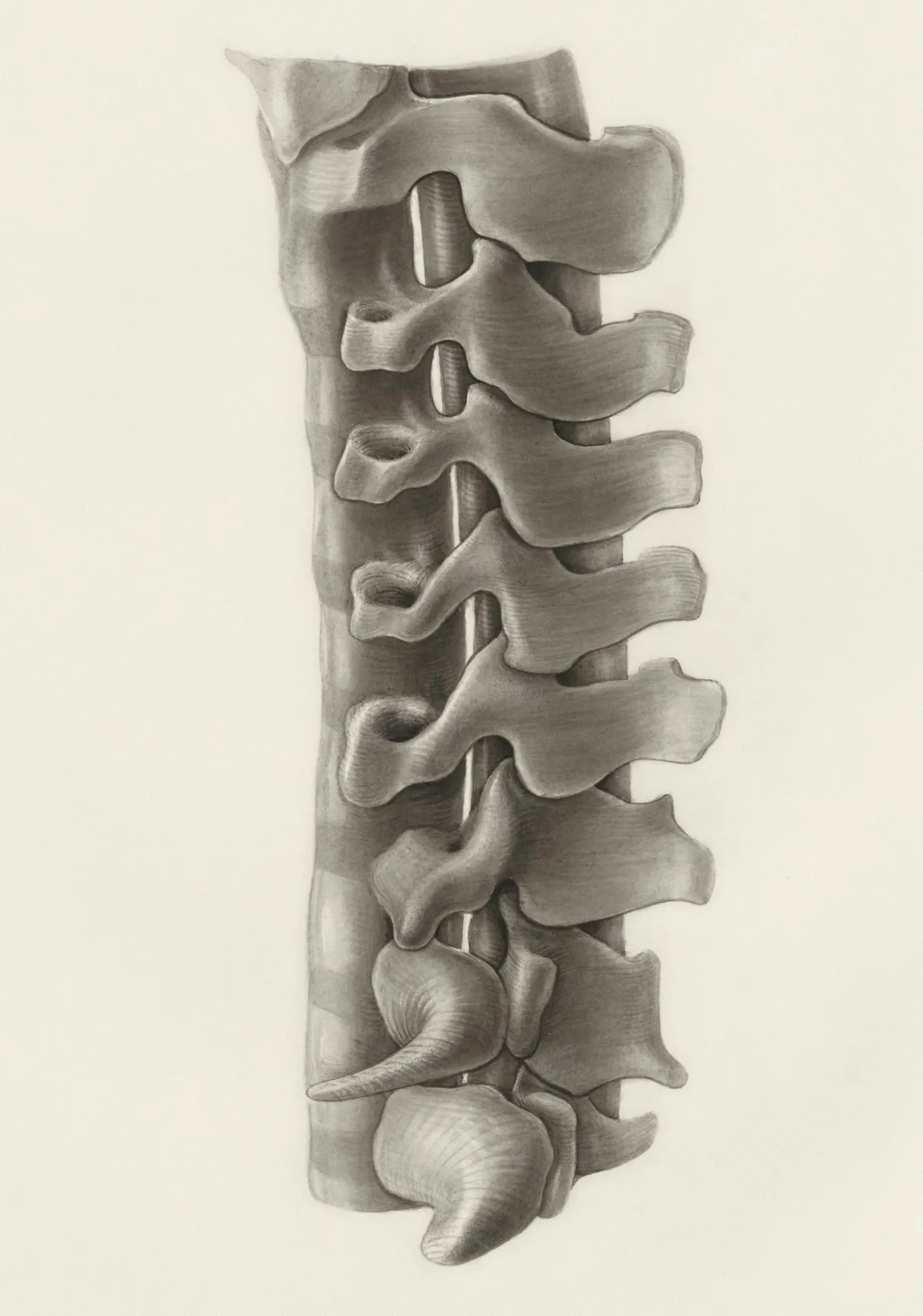 Mesoblast’s Potential Blockbuster Back Pain Therapy Moves Closer as Phase 3 Treatment Completes