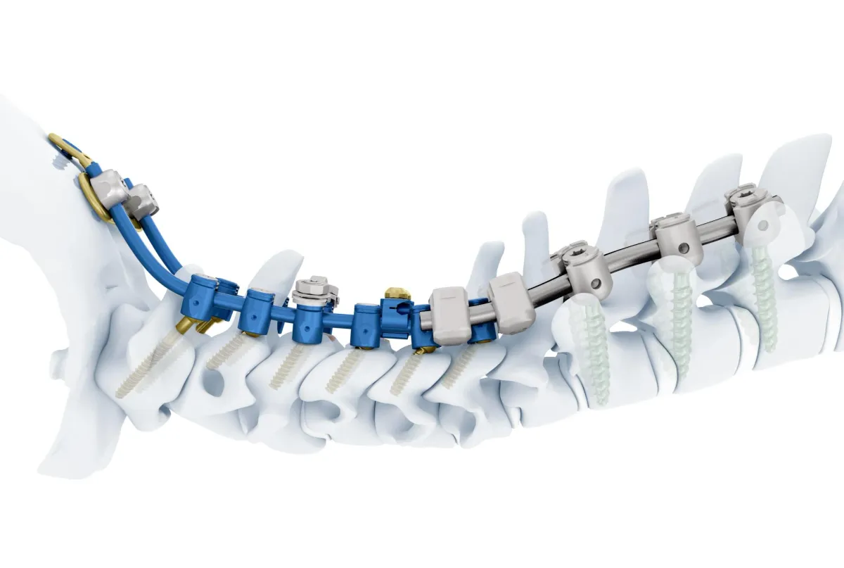 Johnson & Johnson Weighs $20 Billion Sale of Its Orthopedics Unit to Apollo